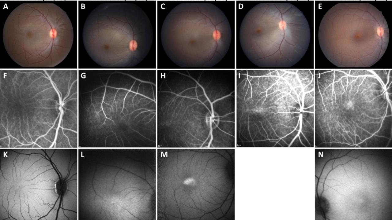 FIVE RESEARCH TEAMS WILL DEVELOP NEW MODELS FOR EYE DISEASE RESEARCH
