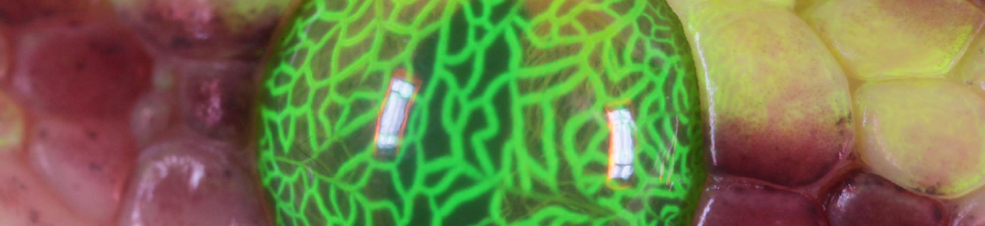 Fluorescein angiography of the snake spectacle